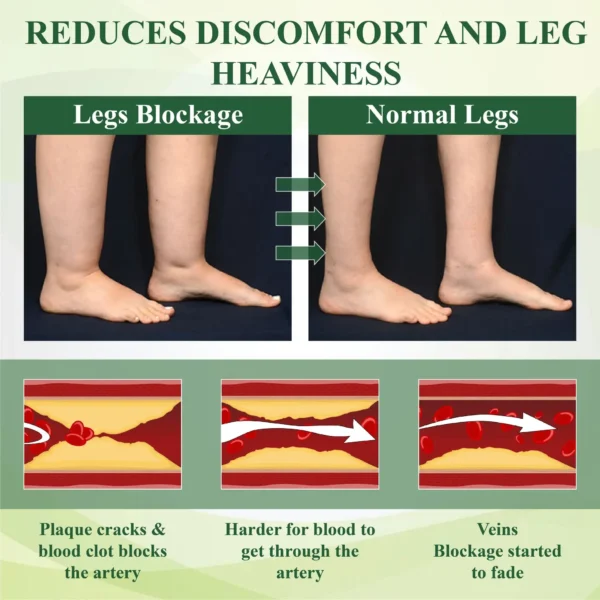 ATTDX® ChestnutEase Edema Massage Herbal Cream