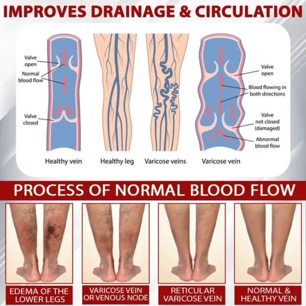 ATTDX® Red Vine FluidRelief Edema Gel