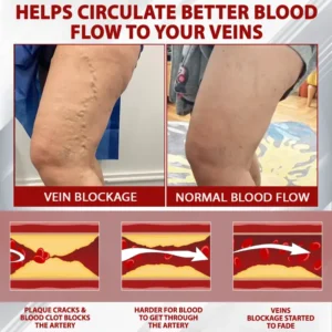 ATTDX® Red Vine FluidRelief Edema Gel