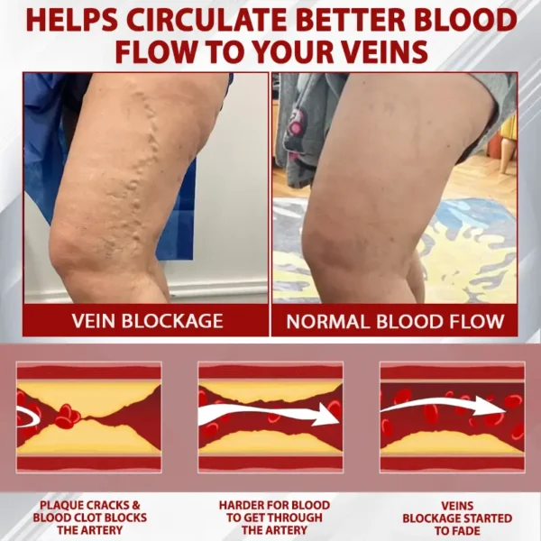 ATTDX® Red Vine FluidRelief Edema Gel