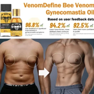 Bulkrion® Venom Define Bee Venom Gynecomastia Oil