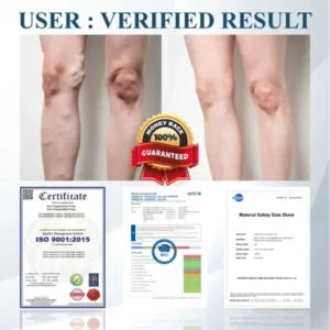 ATTDX® Black Cumin Edema Detox Herbal Cream
