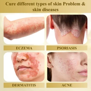 ATTDX® Condense Mellifera Venom Skin Repairing Cream