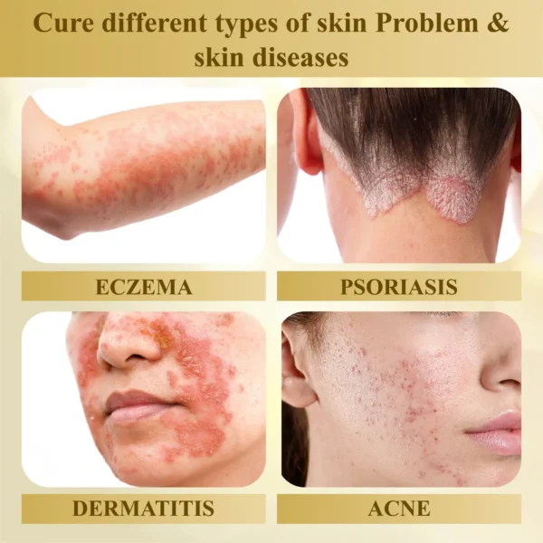 ATTDX® Condense Mellifera Venom Skin Repairing Cream