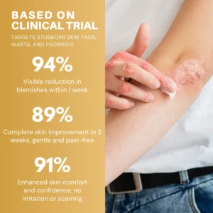 ATTDX® Condense Mellifera Venom Skin Repairing Cream