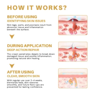 ATTDX® Condense Mellifera Venom Skin Repairing Cream