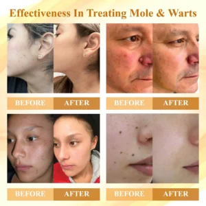 ATTDX® Condense Mellifera Venom Skin Repairing Cream