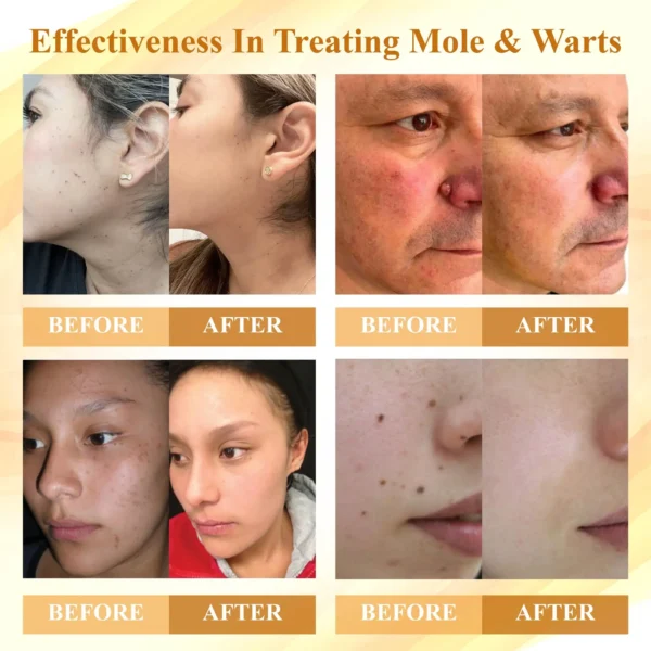 ATTDX® Condense Mellifera Venom Skin Repairing Cream