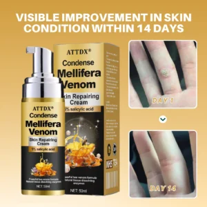 ATTDX® Condense Mellifera Venom Skin Repairing Cream
