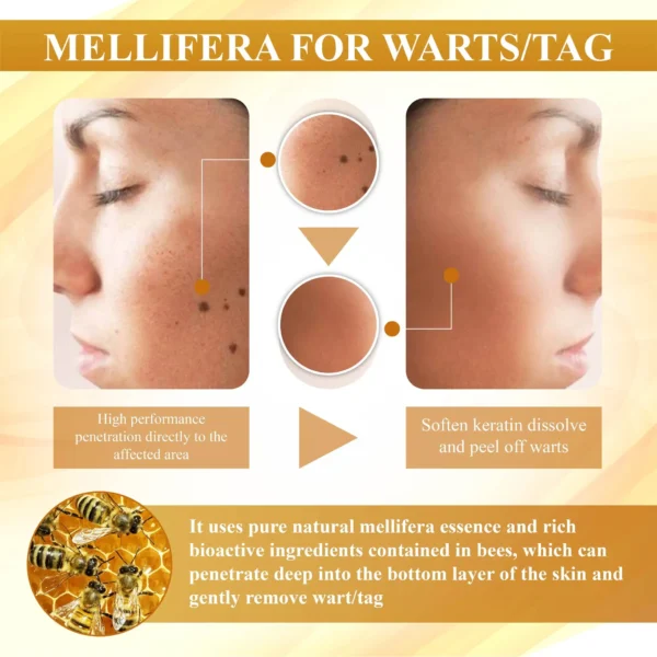 ATTDX® Condense Mellifera Venom Skin Repairing Cream