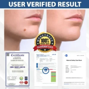 ATTDX® DermaSoft Tag & Mole Clear Gel