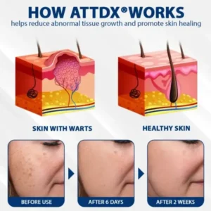 ATTDX® DermaSoft Tag & Mole Clear Gel