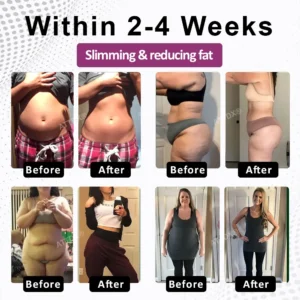 ATTDX® FemmeShape GutSlim Probiotics