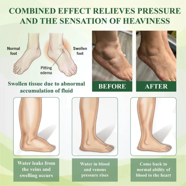 ATTDX® FlowBoost Edema Drain Herbal Roll On