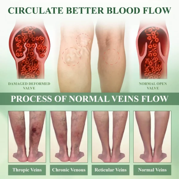 ATTDX® FluidEx Circulation & Drainage Capsules