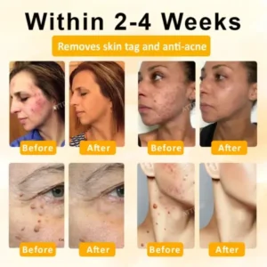 ATTDX® GoldenBee Tag & Blemish Repair Peel Gel Mask