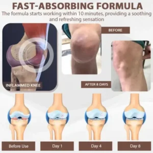 ATTDX® InflameHeal Black Cumin Bone Relief Gel