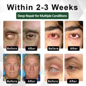 ATTDX® NanoCore Eye Clear Drops Serum
