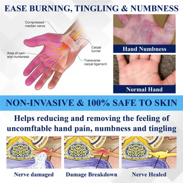 ATTDX® NerveRelief LC Medical Treatment Cream