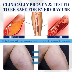 ATTDX® NerveRelief LC Medical Treatment Cream