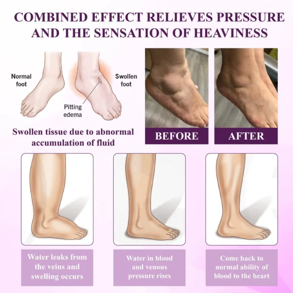 ATTDX® Night-Time Edema Relief Sleep Cream