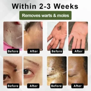 ATTDX® Skin Clear Herbal Jelly Gel