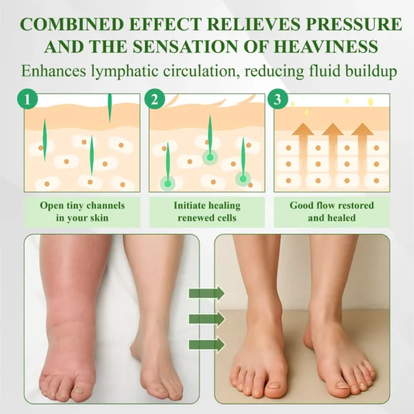 ATTDX® SpiculeFlow Advanced Edema Drainage Cream