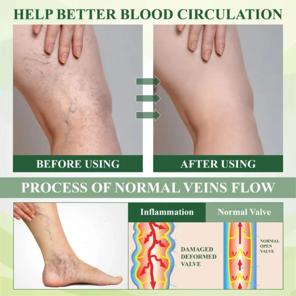 ATTDX® SpiculeFlow Advanced Edema Drainage Cream