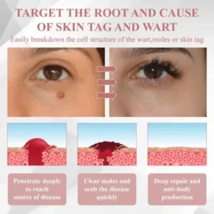 ATTDX® Tag & Blemish Peel-Off Gel Wrapping Mask