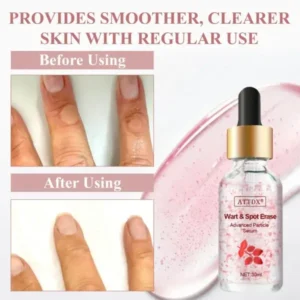 ATTDX® Wart & Spot Erase Advanced Particle Serum