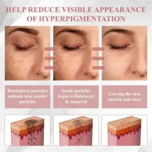 ATTDX® Wart & Spot Erase Advanced Particle Serum