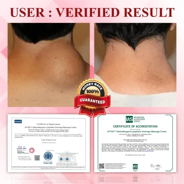 ATTDX® EdemaCare Lymphatic Drainage Massage Cream
