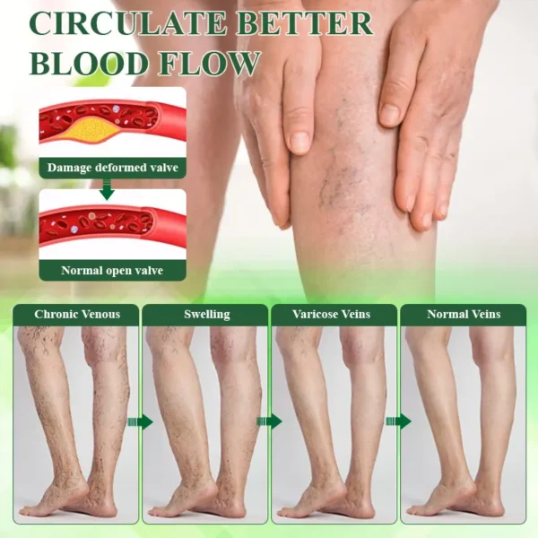 ATTDX® HerbalDrain Edema Comfort Massage Cream
