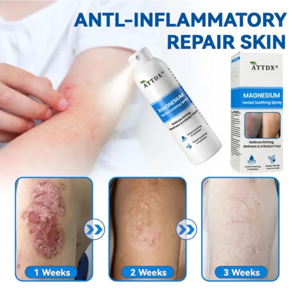 ATTDX® Magnesium Herbal Soothing Spray