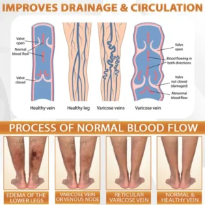 ATTDX® MicroSting Bee Vein Ease Patches