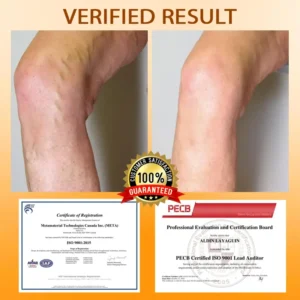 ATTDX® MicroSting Bee Vein Ease Patches