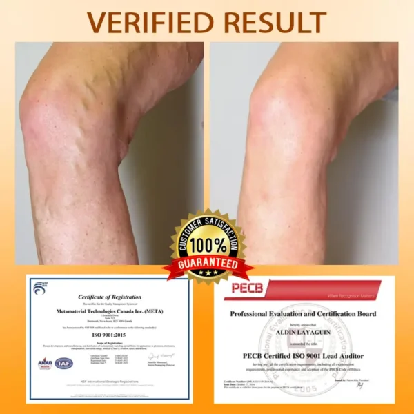 ATTDX® MicroSting Bee Vein Ease Patches