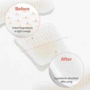 ATTDX® MicroSting Bee Vein Ease Patches