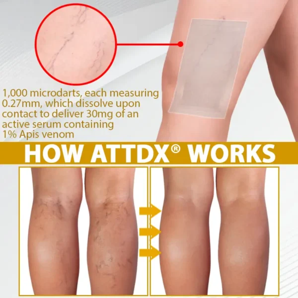 ATTDX® MicroSting Bee Vein Ease Patches