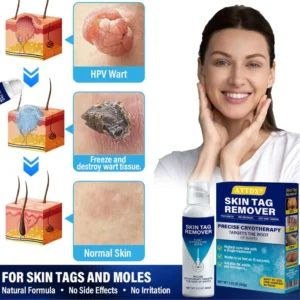 ATTDX® TagRecede Cryo Treatment Spray
