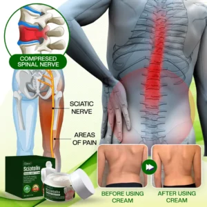 ODEIUN™ Sciatoliv Sciatica Relief Cream