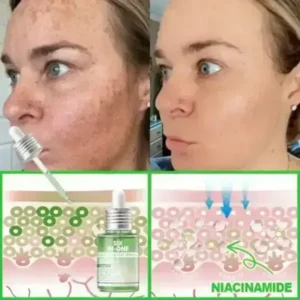 𝐎𝐫𝐢𝐚𝐜𝐡® 𝐀𝟏𝟎+ 𝟔-𝐢𝐧-𝟏 𝐃𝐞𝐫𝐦𝐚𝐑𝐞𝐩𝐚𝐢𝐫 𝐒𝐞𝐫𝐮𝐦