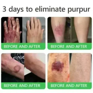 𝐎𝐫𝐢𝐚𝐜𝐡® 𝐀𝟏𝟎+ 𝟔-𝐢𝐧-𝟏 𝐃𝐞𝐫𝐦𝐚𝐑𝐞𝐩𝐚𝐢𝐫 𝐒𝐞𝐫𝐮𝐦