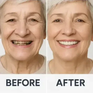 【Official Brand Store】Custom-Fit Functional Dentures — ComfortMax Edition