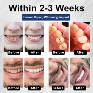 ATTDX® BioEnamel Biomimetic Tooth Armor Drops