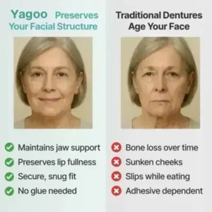 Yagoo™ Medical Full Denture with Strong Suction